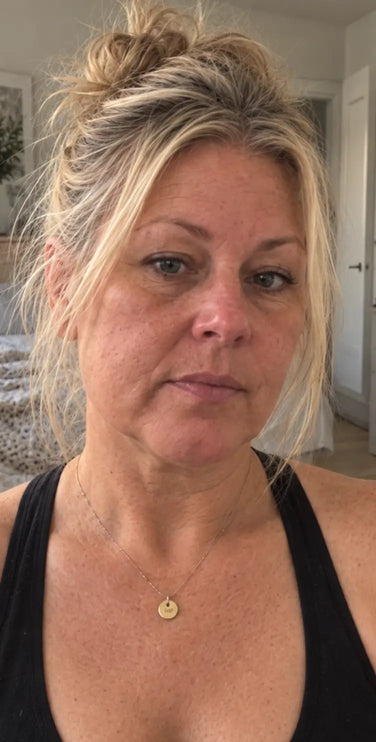 Amanda, 46, at Week 1 — Waking up with a puffy, swollen-looking face
